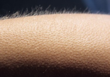 Goosebumps